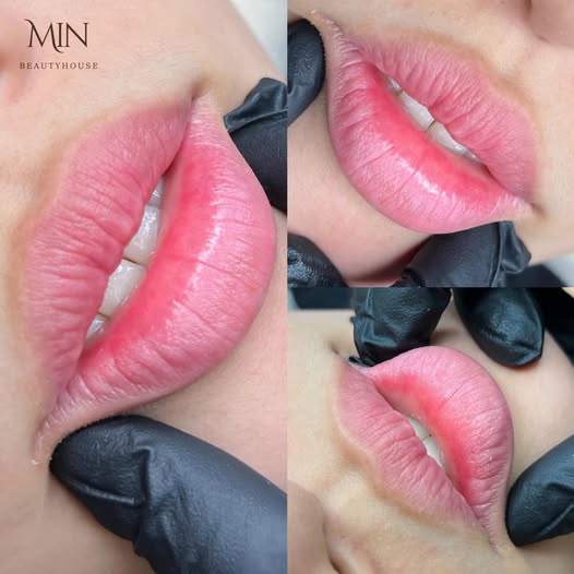 Phun môi thẩm mỹ Thành phố Hồ Chí Minh